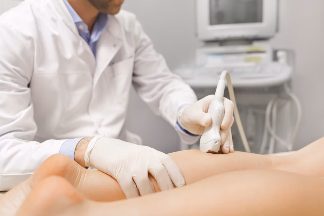 Color Doppler vena i arterija nogu pregled u Zagrebu